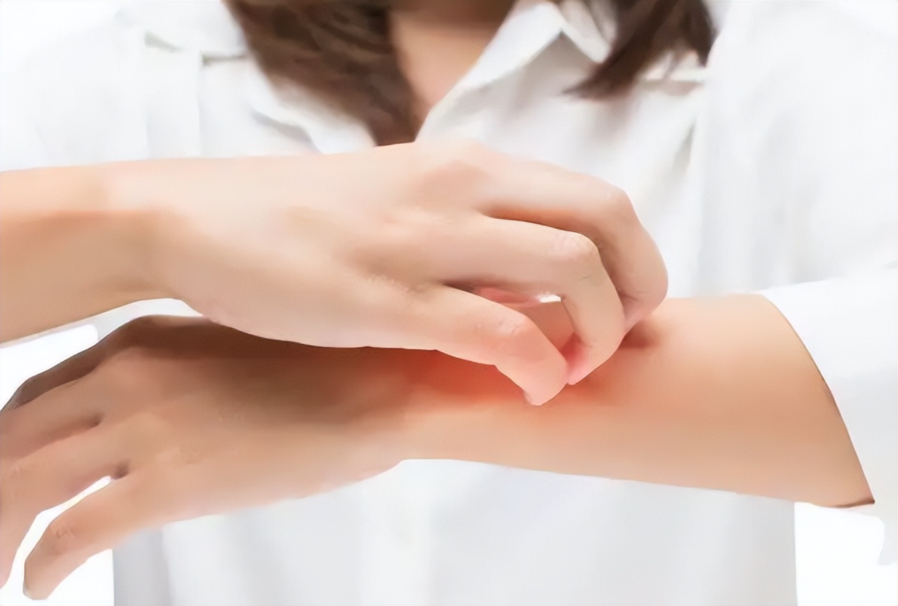 炉甘石洗剂功效多少钱一瓶,世卫组织推荐炉甘石