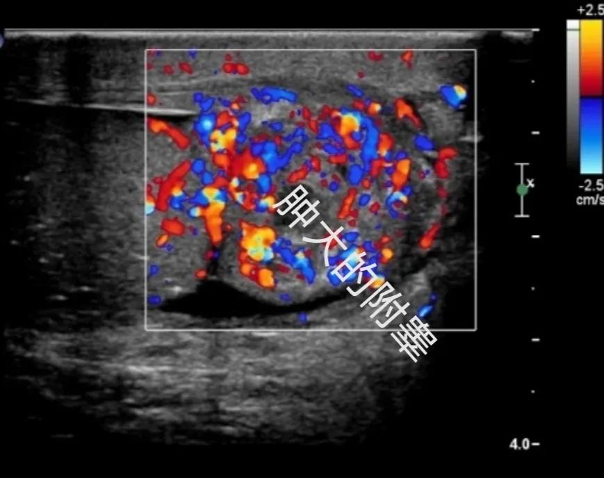 男性睾丸红肿是什么原因,男性睾丸红肿瘙痒
