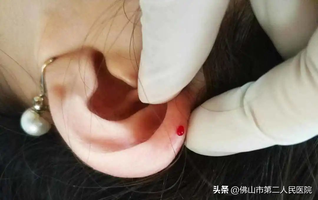 女子熬夜打牌的危害,打牌后耳鸣怎么回事