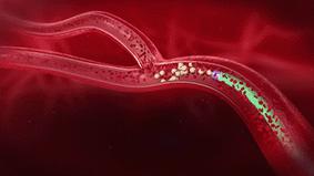 抗癌再添“核*器武**”，打一针可治疗肝癌，费用或只需几万