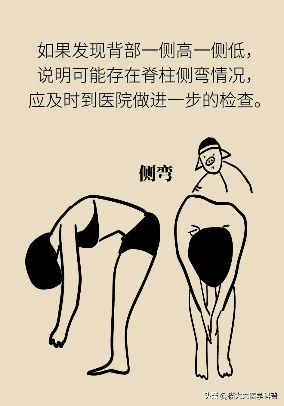 孩子老是驼着背走路感觉没自信,五十岁背有点驼怎么办