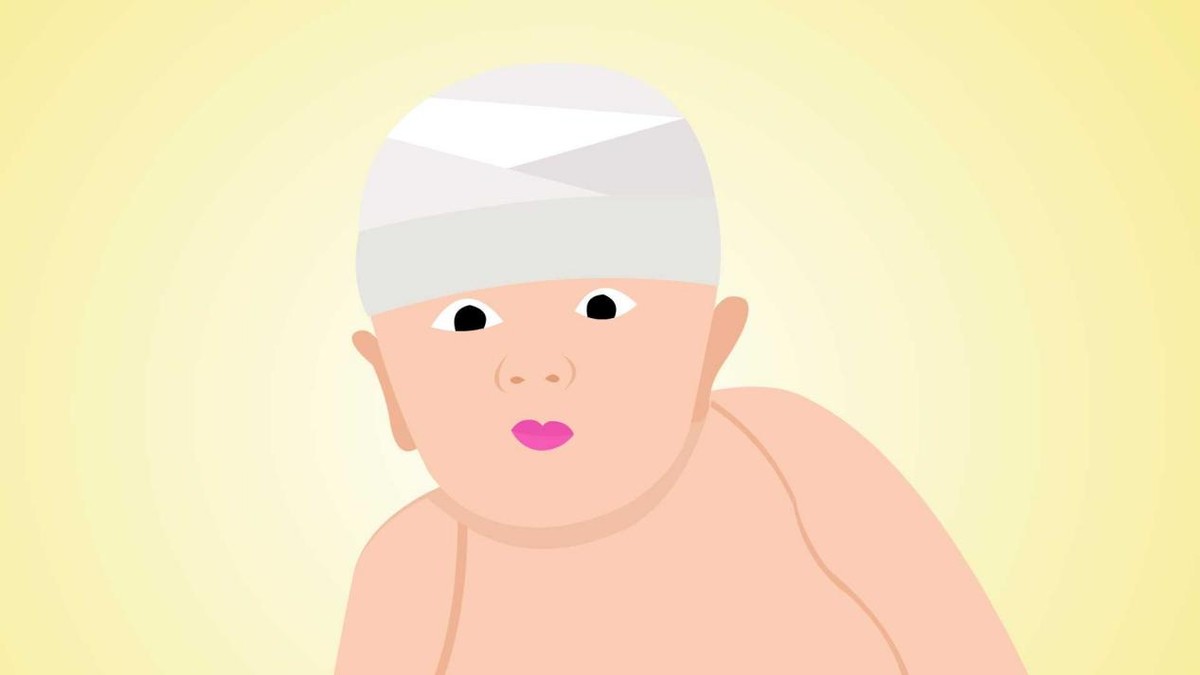 先天性脑积水能坚持多久,成人先天脑积水有必要治疗吗