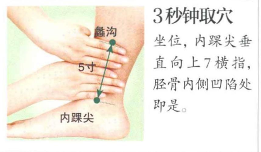 蠡沟穴——调理妇科炎症经验穴