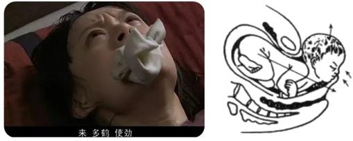 孕妈妈怎么判断胎位是正的,胎儿屁股在右侧是什么胎位