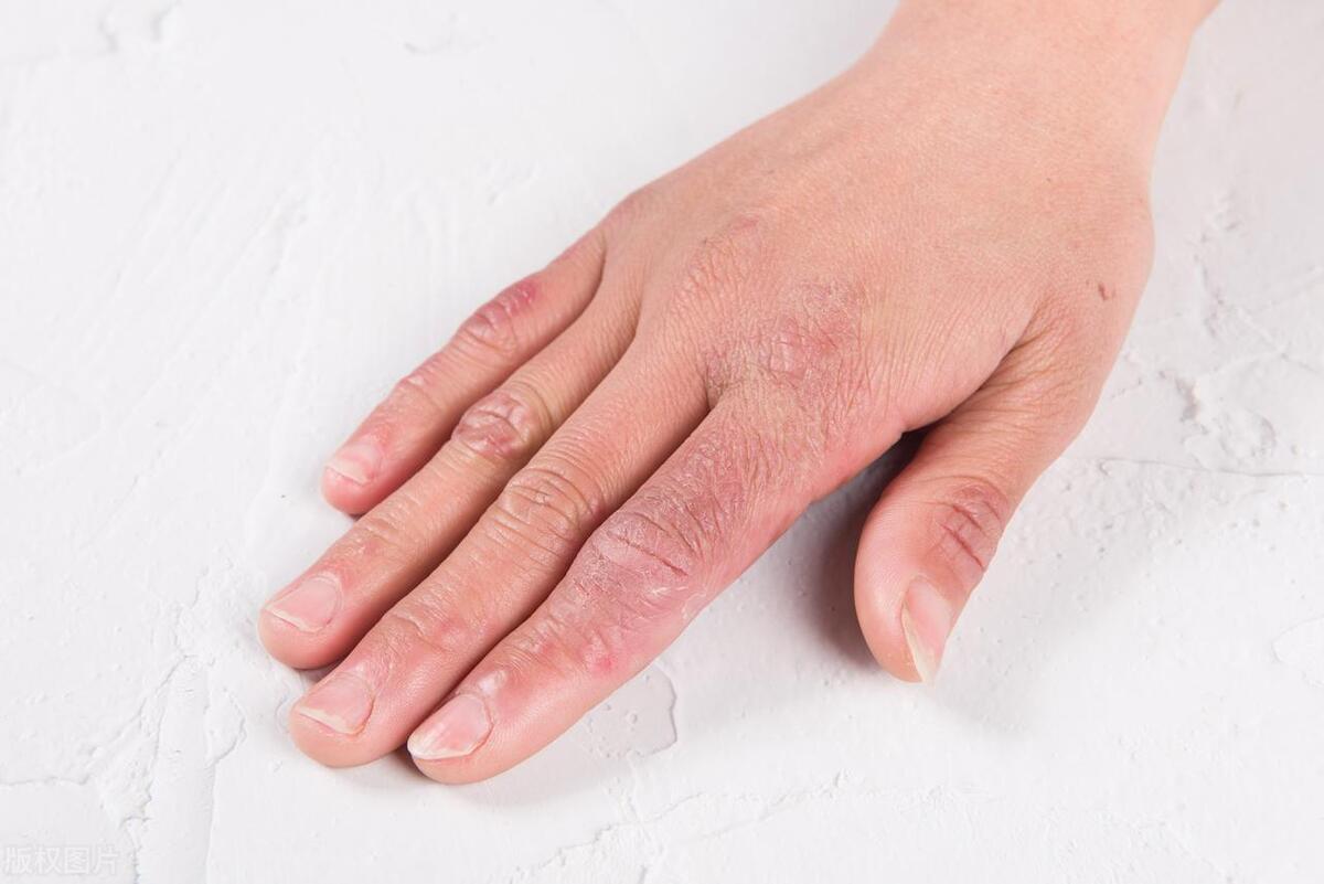 google视觉识别,googlelens还有哪些实用功能