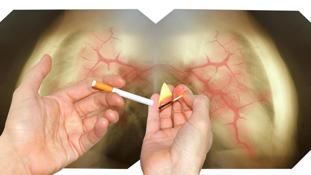 上了年纪也要注意身体,上了年龄身体需要体检