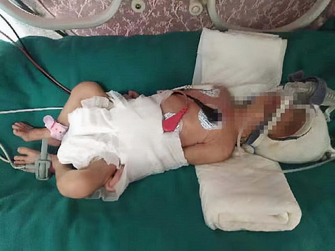 缅甸姑娘嫁中国湖北,缅甸女孩嫁中国小伙生下双胞胎