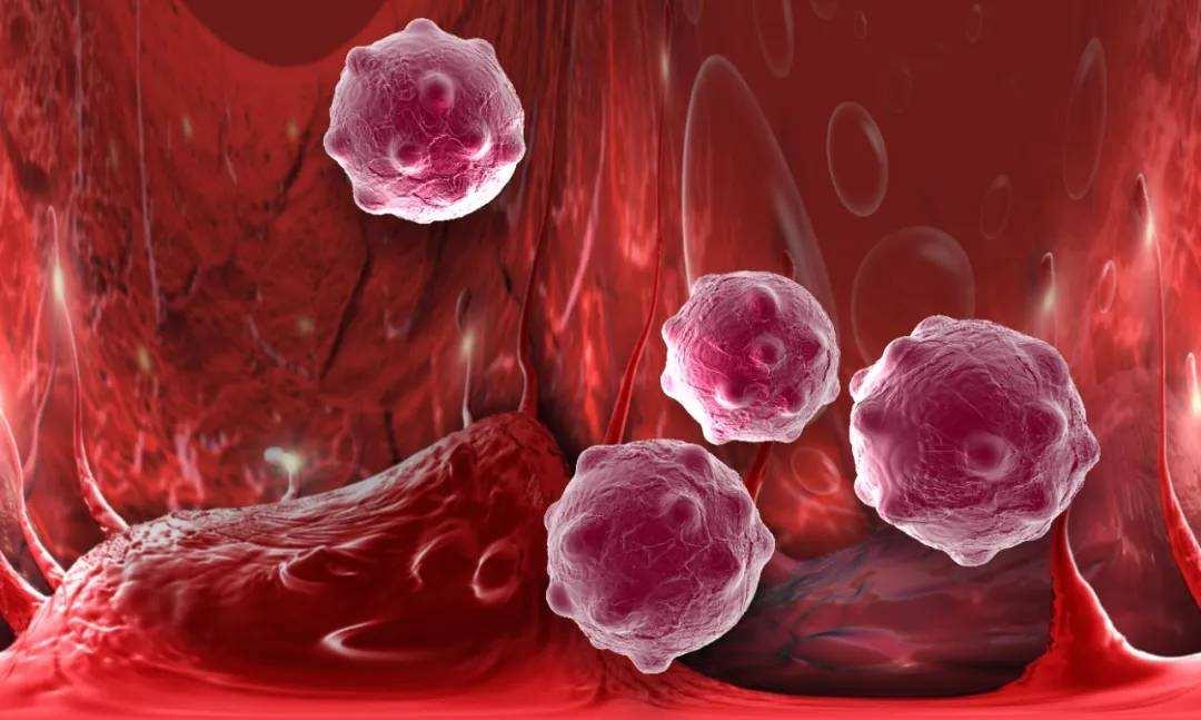 癌症患者临死前的8个征兆,癌症患者自述生病诱因