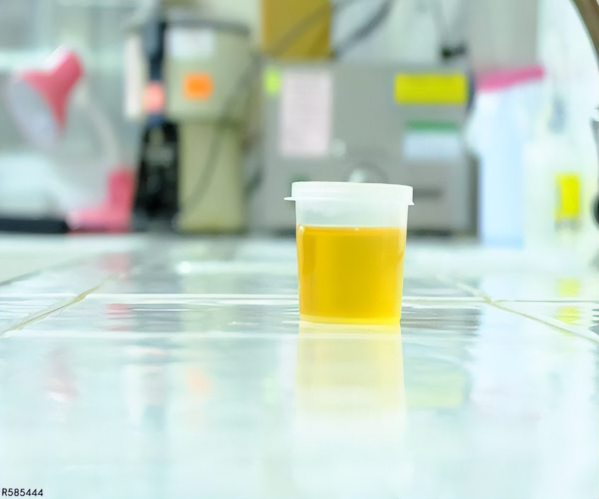 机体检测出HPV阳性,有必要治疗吗?这5个知识,女性需事先了解下