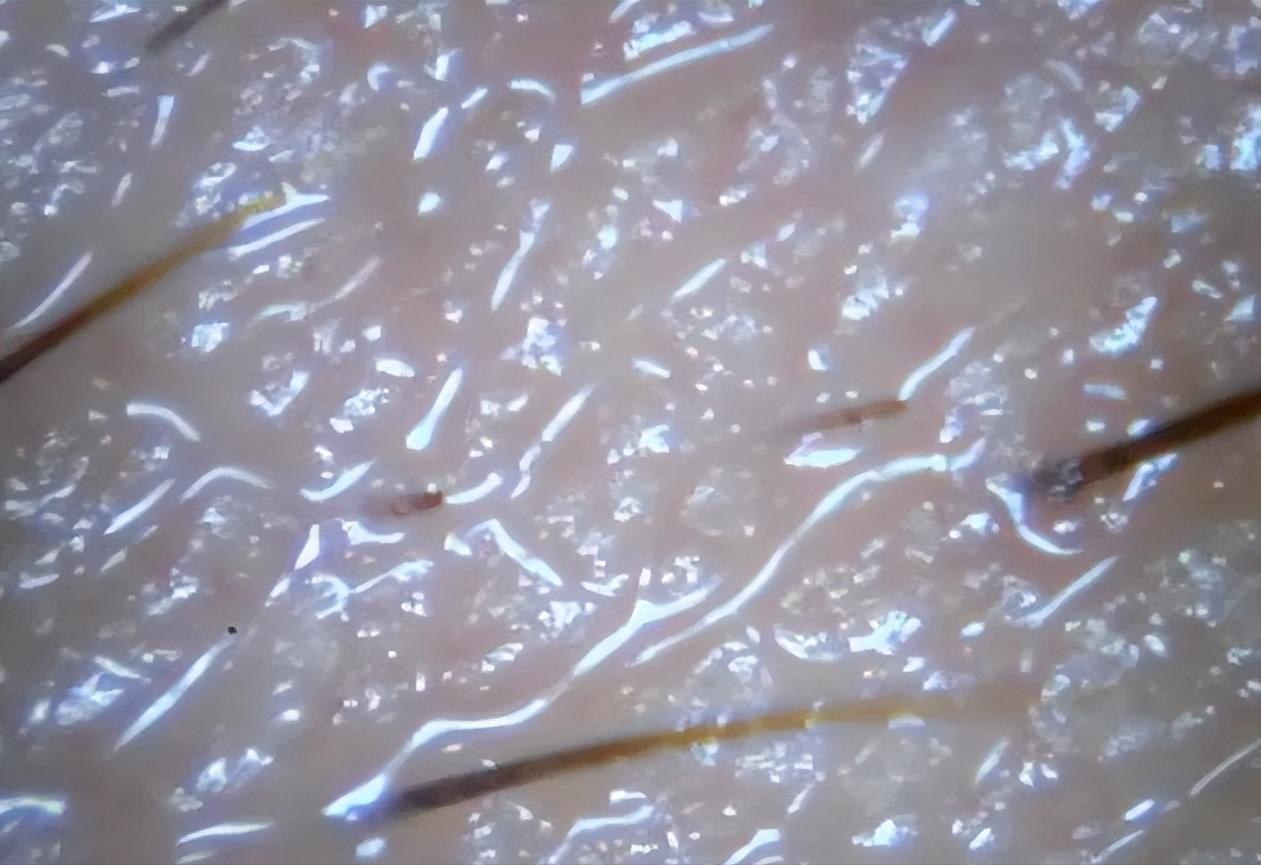 脸泛红是洗面奶的原因吗,为什么用完洗面奶脸会变白