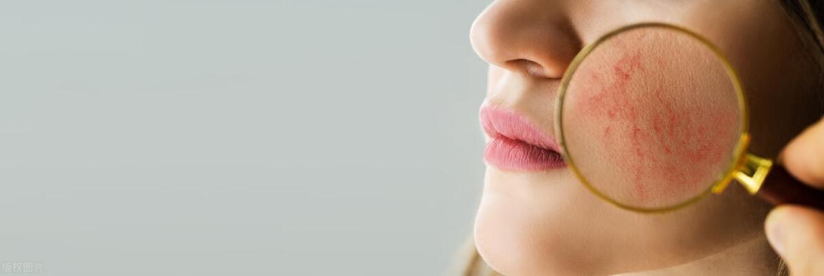 皮肤过敏发红怎么护肤,皮肤干敏起皮泛红怎么快速修复