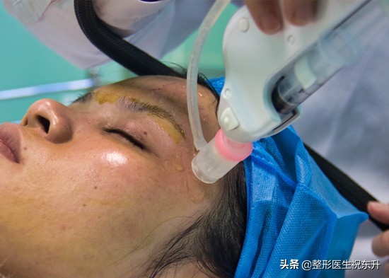 马上要回家过年了，给你们推荐一个能短期变美的整容项目：水光针