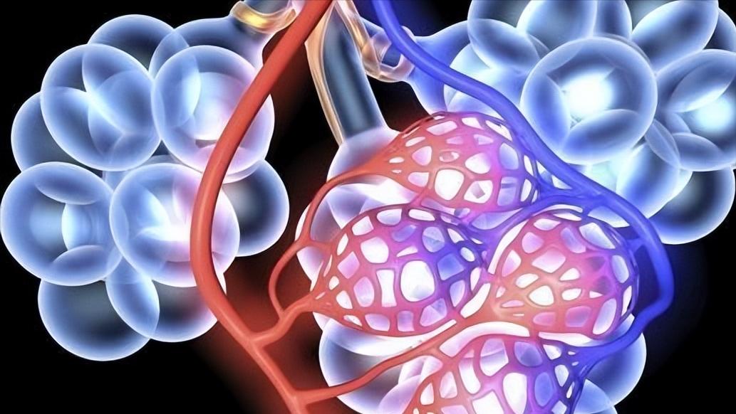 得了肺大泡怎么办,体检有肺大疱