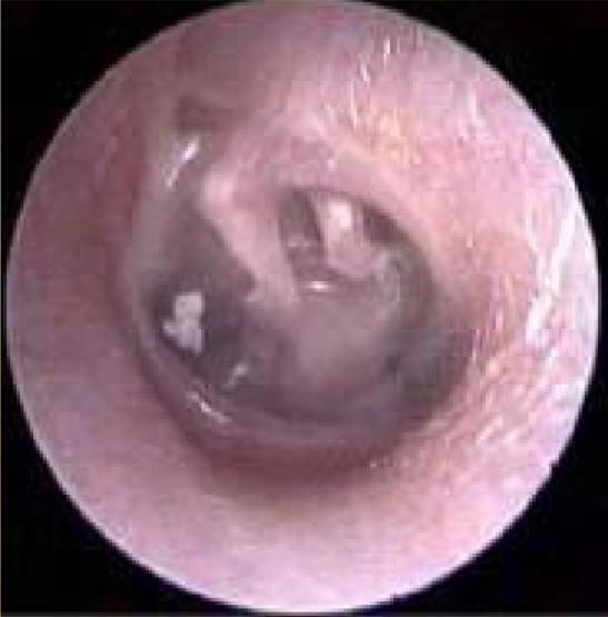 爱耳小知识,爱耳日科普