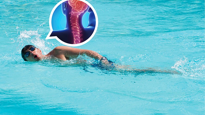 治疗强直性脊柱炎必须按体质治吗,针对强直性脊柱炎最好的锻炼方法