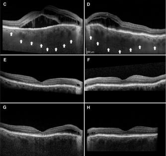 阐幽明微，言必有中丨戴荣平教授：PPS的临床特征和治疗