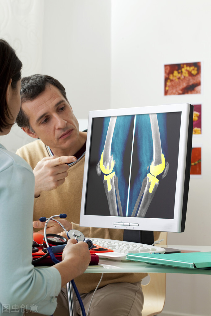 人工膝关节置换手术后，一个月时间里度日如年