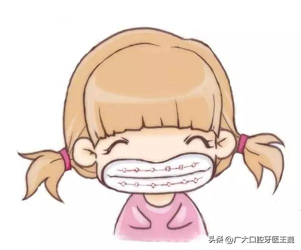 正畸人必看,正畸面诊多看几家