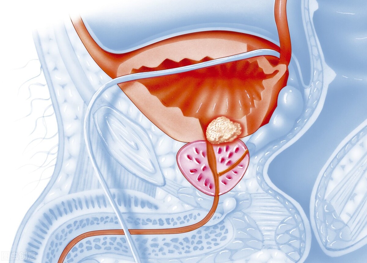 男人缺性激素会有哪些症状,男人缺睾酮素