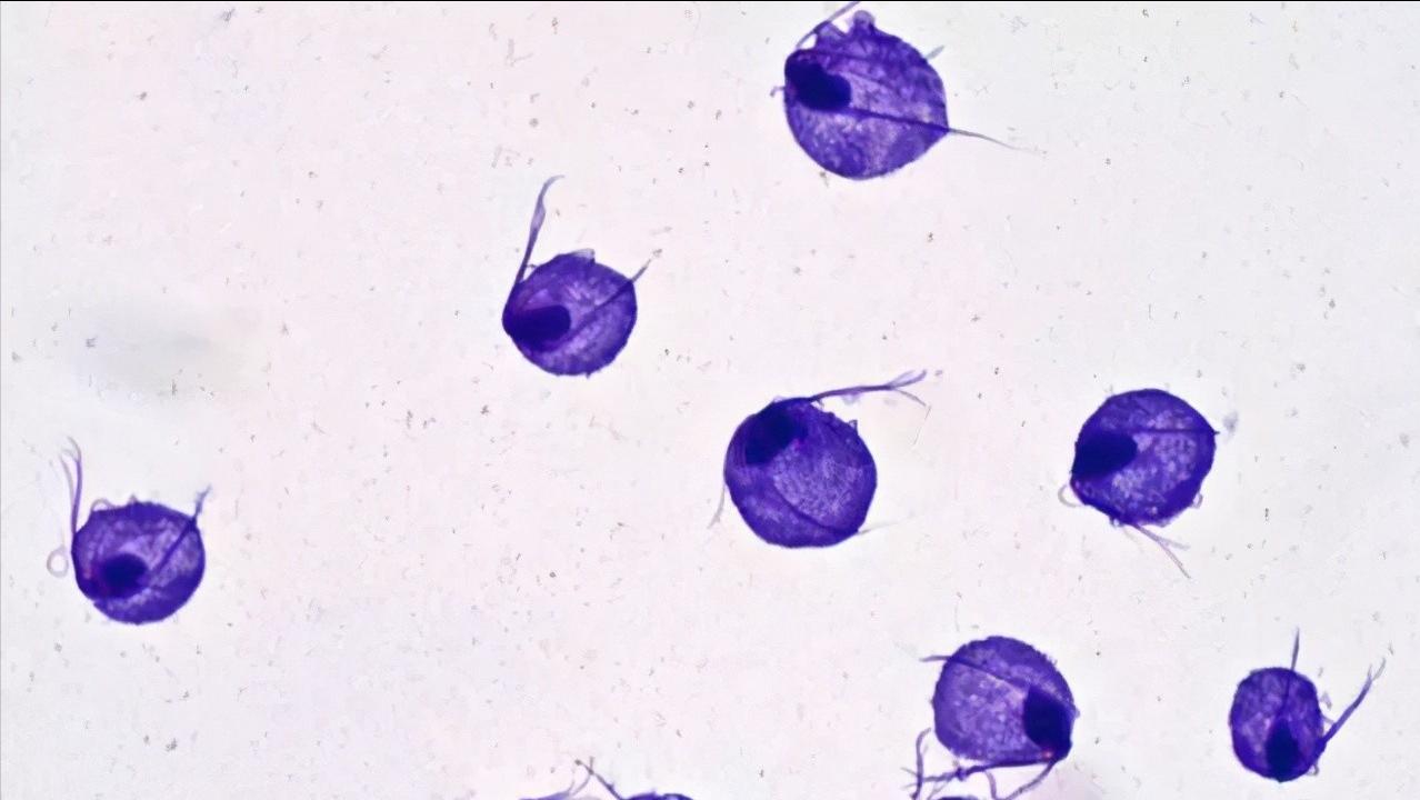 “甲硝唑”便宜又好用，能治什么病？这3种病可适用