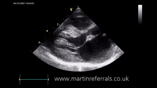 猫肥厚型心肌病分几期,猫得了hcm肥厚型心肌病