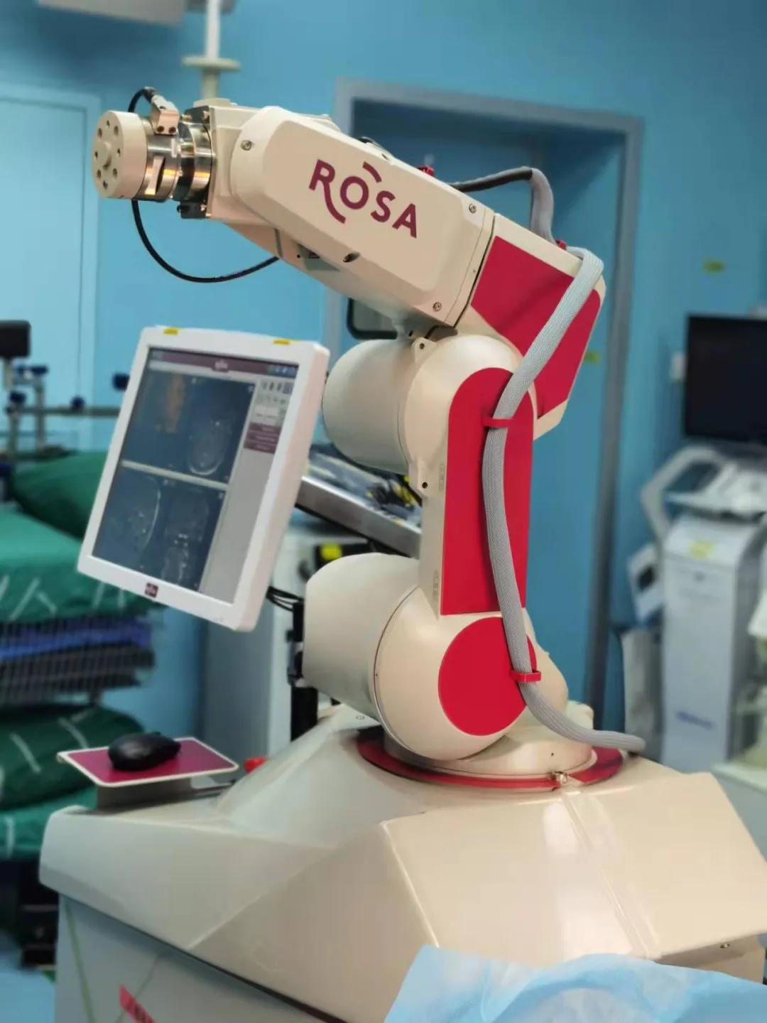 治疗癫痫的新希望,癫痫病人能做慢性小脑电刺激术吗