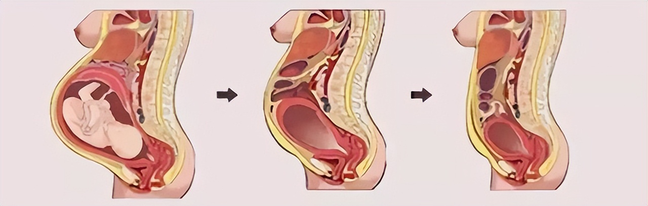 如何知道子宫恢复好了,怎么样知道子宫恢复得好不好