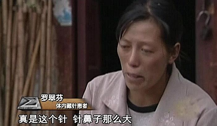 云南女子体内26根绣花针凶手是谁,云南女子缝衣针