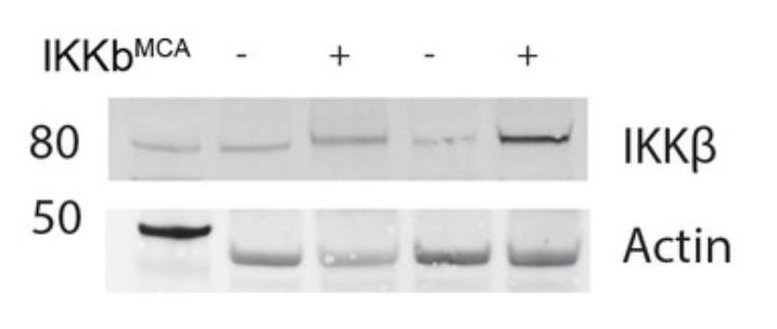核因子,NFκB,在临床治疗上,是否与腱切断术的肌肉萎缩无关?