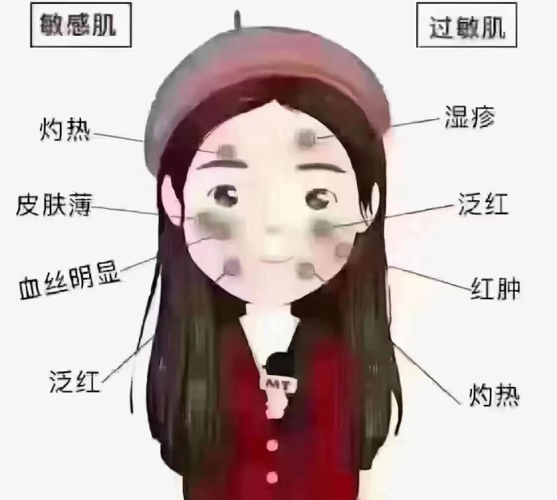 过敏是什么原因引起的,春敏解决方案