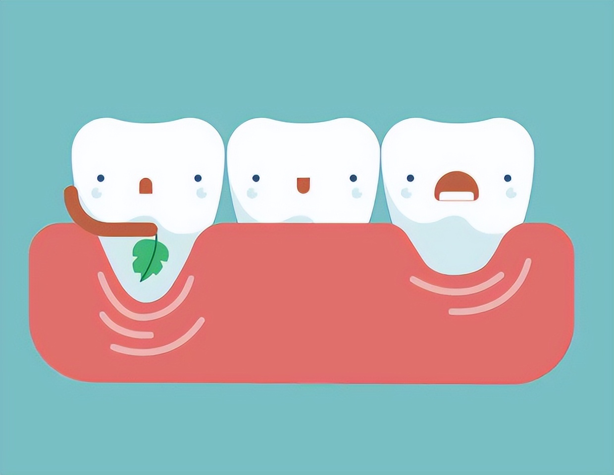 牙结石可以自己抠掉吗,牙结石可以自己抠掉牙根痒怎么办