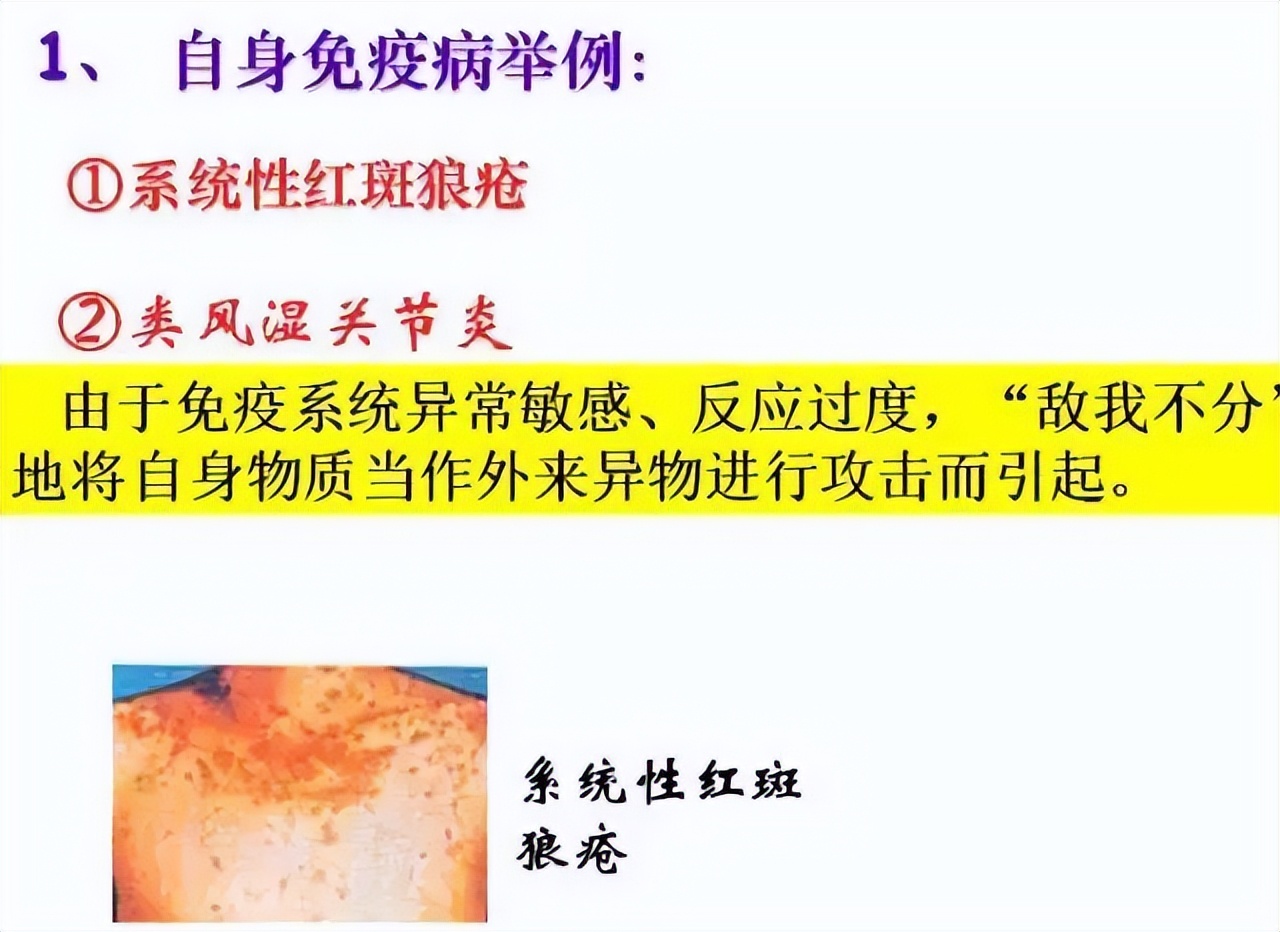 高中生物细胞免疫全知识点视频,生物高中知识点免疫调节