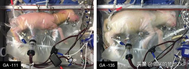 人造子宫对男性好处,人造子宫真的要来了