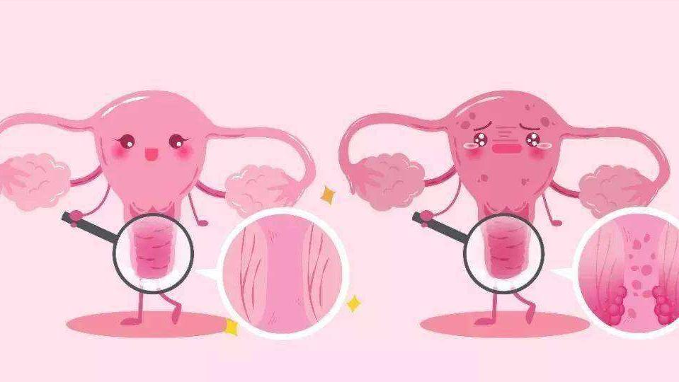 我国宫颈炎的发病率是多少,宫颈炎是什么原因引致的