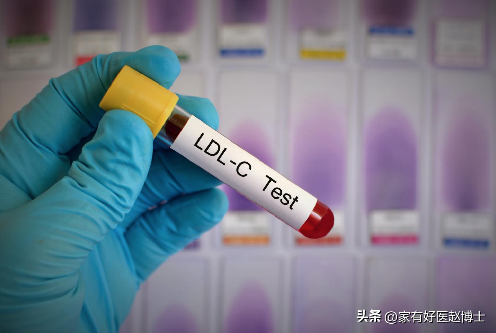 胆固醇正常以后他汀还要吃吗,胆固醇高吃他汀要一直吃吗