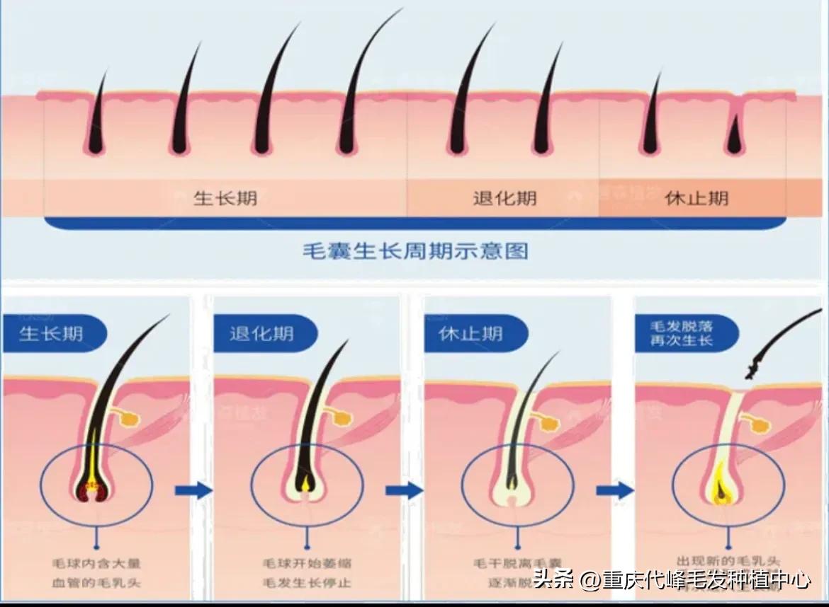 快速脱发的药物,如何抑制脱发视频
