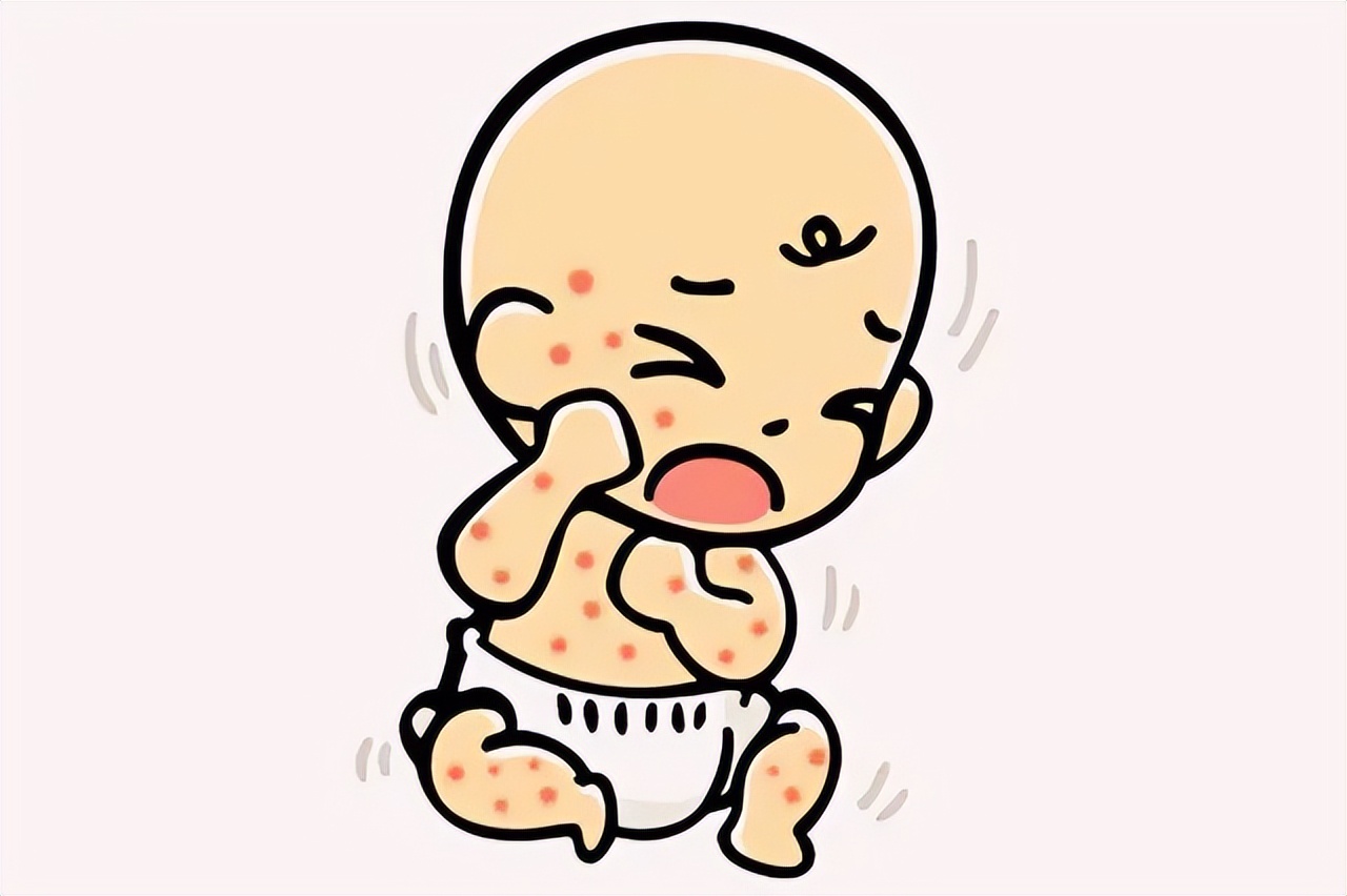 2周半宝宝有湿疹反复发作怎么办,宝宝湿疹反复发作老好不了怎么办