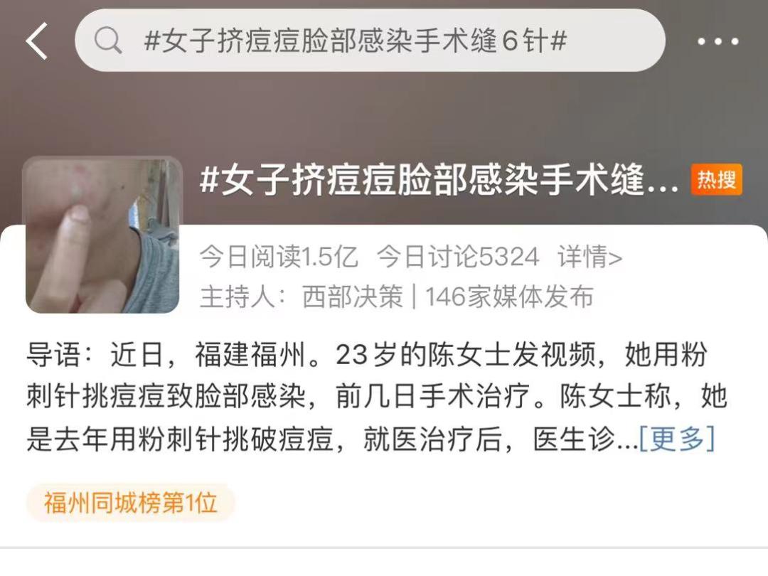 女生挤痘痘导致面部感染怎么办,女生挤痘痘导致面部感染