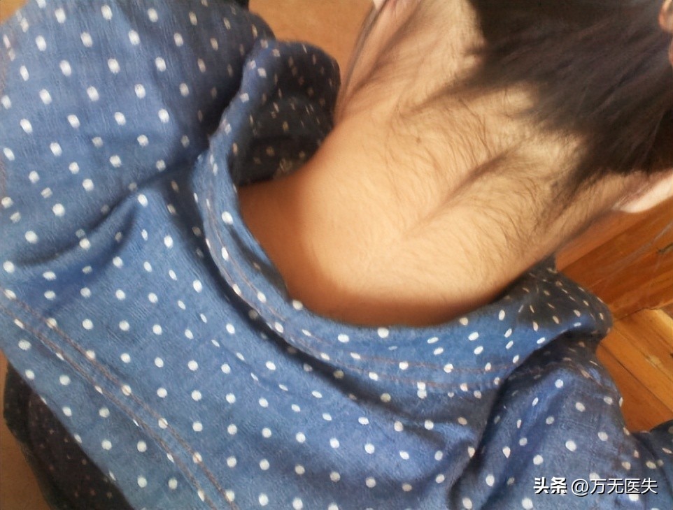 为什么有人“下面”没毛？女性*处私**毛发的秘密，别羞于了解