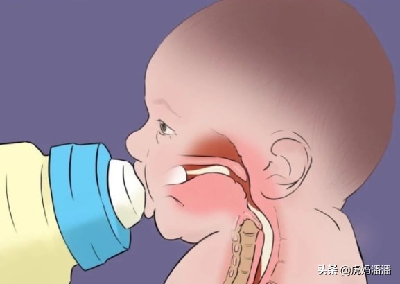 呛奶导致窒息如何抢救,宝宝突然呛奶正确处理方法