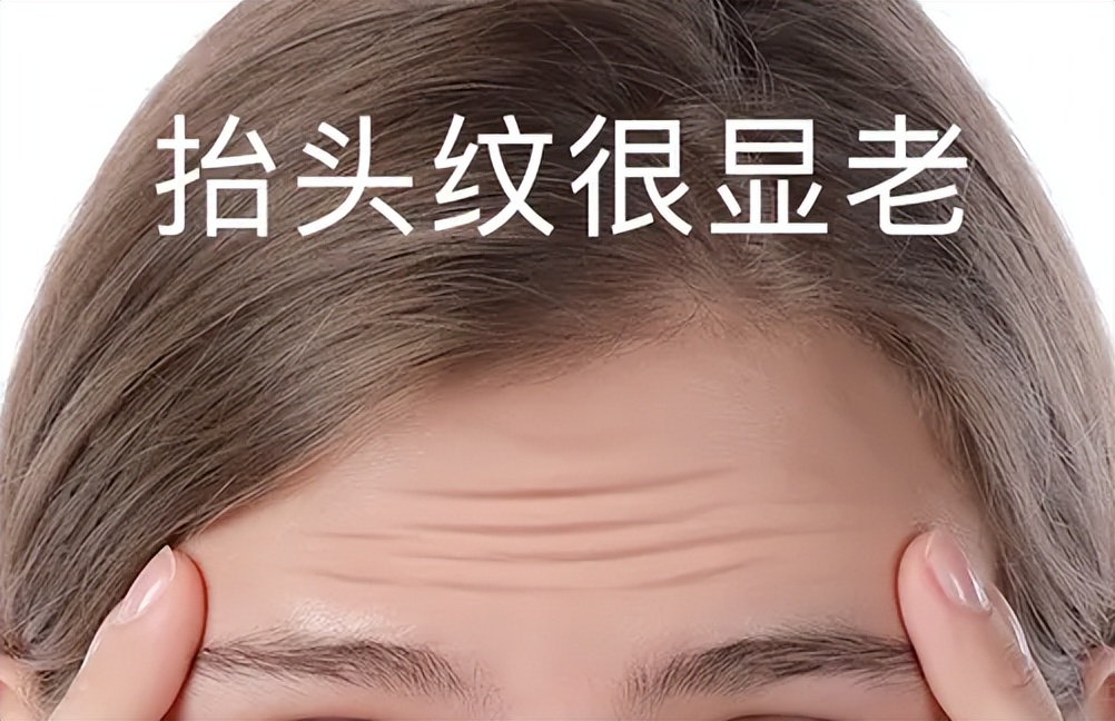 有效抗皱改善抬头纹,学生抬头纹怎么改善