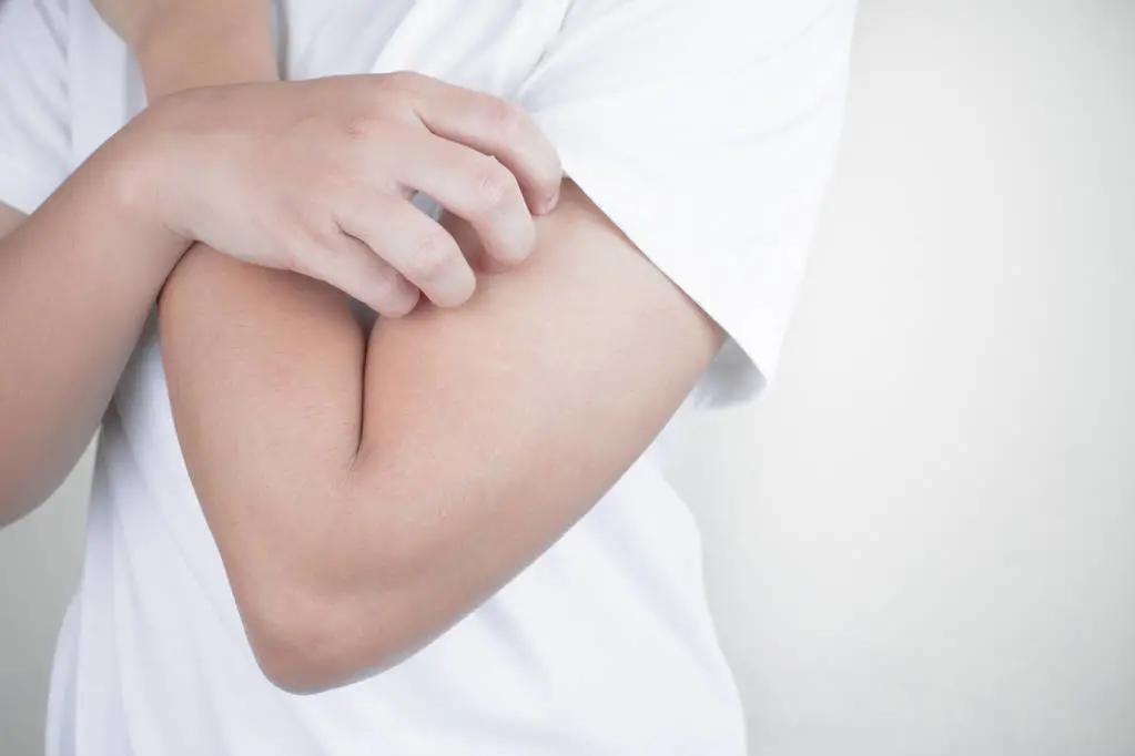 冬天皮肤干燥瘙痒还起红疹怎么办,冬天皮肤干燥易过敏用什么保湿好