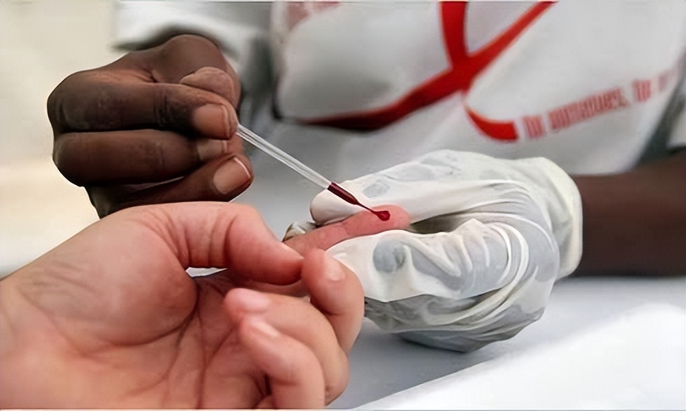 艾滋病的口腔症状有哪些？不妨查看自己是否有这3个“迹象”