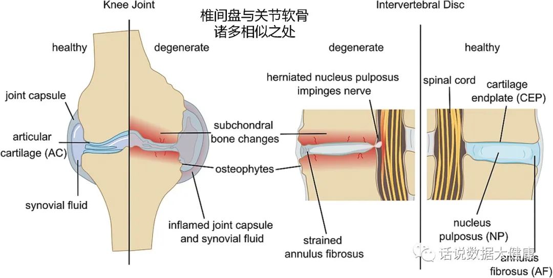 疼痛冷敷凝胶,疼痛冷敷凝胶的功效