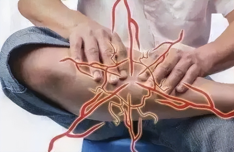 腿部动脉硬化的症状表现,动脉硬化的症状有哪些表现