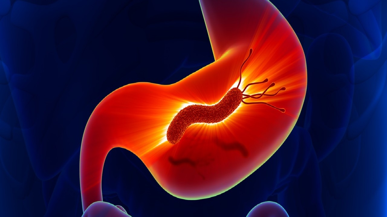 治疗幽门螺杆菌吃4种药太麻烦？医生：新疗法只用两种药