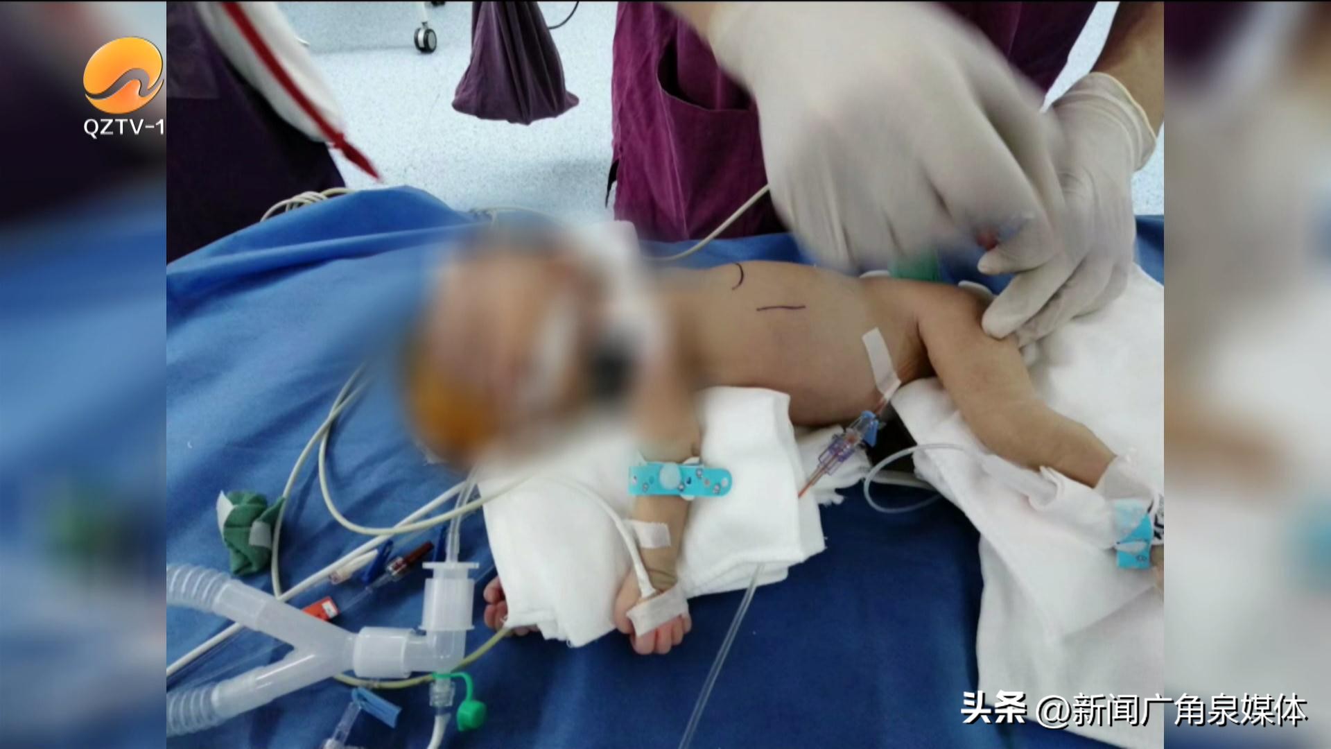 福建省儿童医院心脏介入,泉州儿童医院心外科