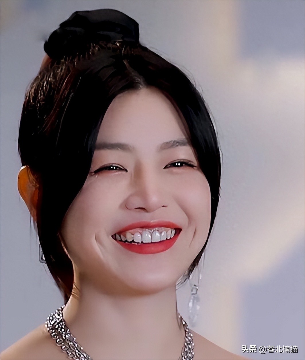 明星嘴突戴牙套前后对比,明星和假牙