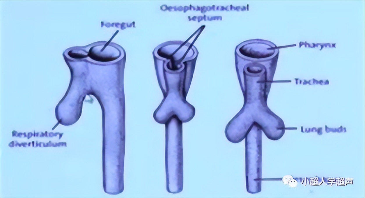 超声影像小视频,食道闭锁超声表现