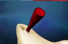 崴脚怎么知道复位了,崴脚别慌4招教你快速康复